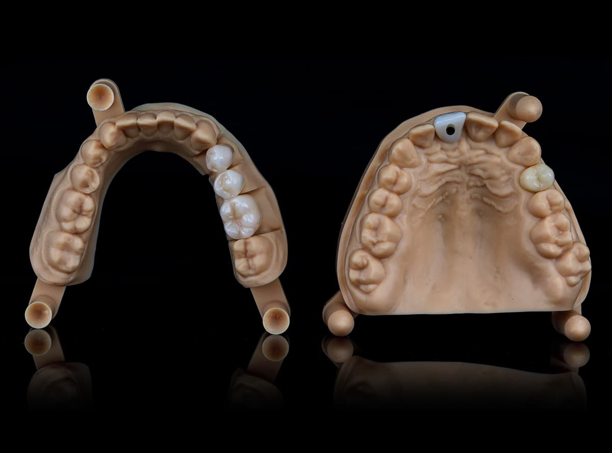 3D Printed model