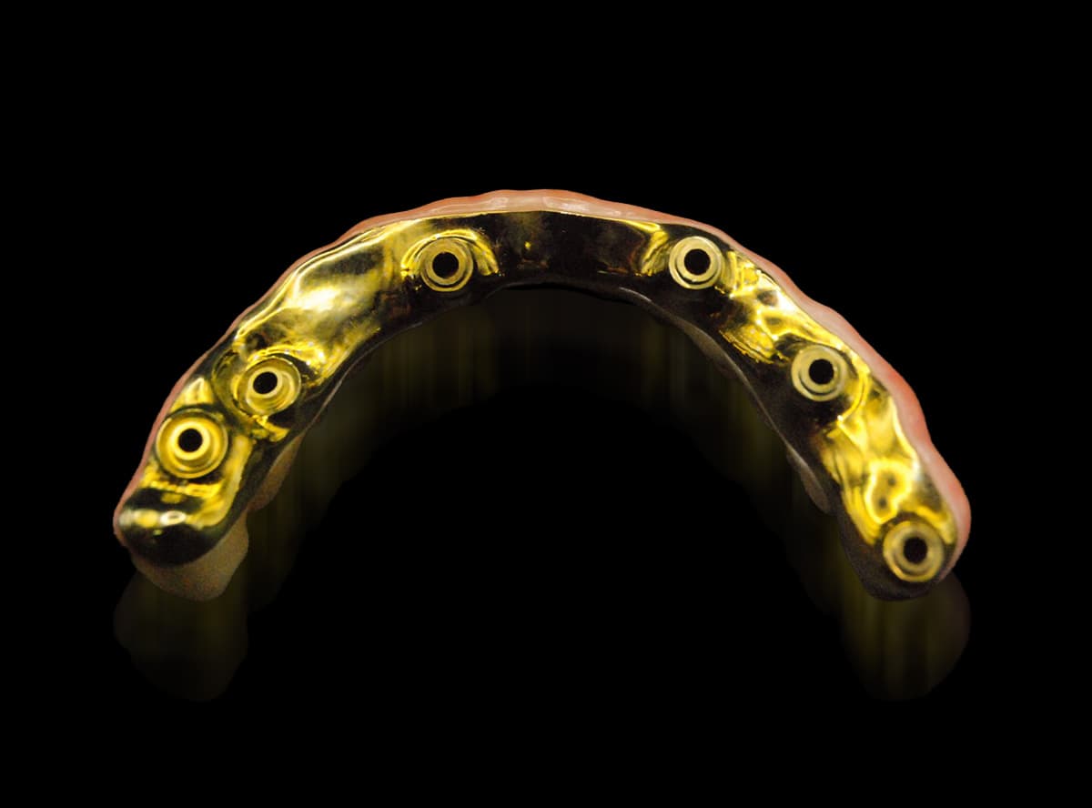 All-On-X/Implant Bars