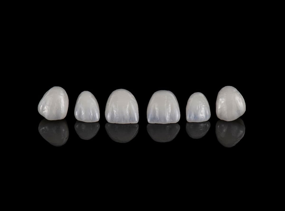 Crown / Bridge / Veneer