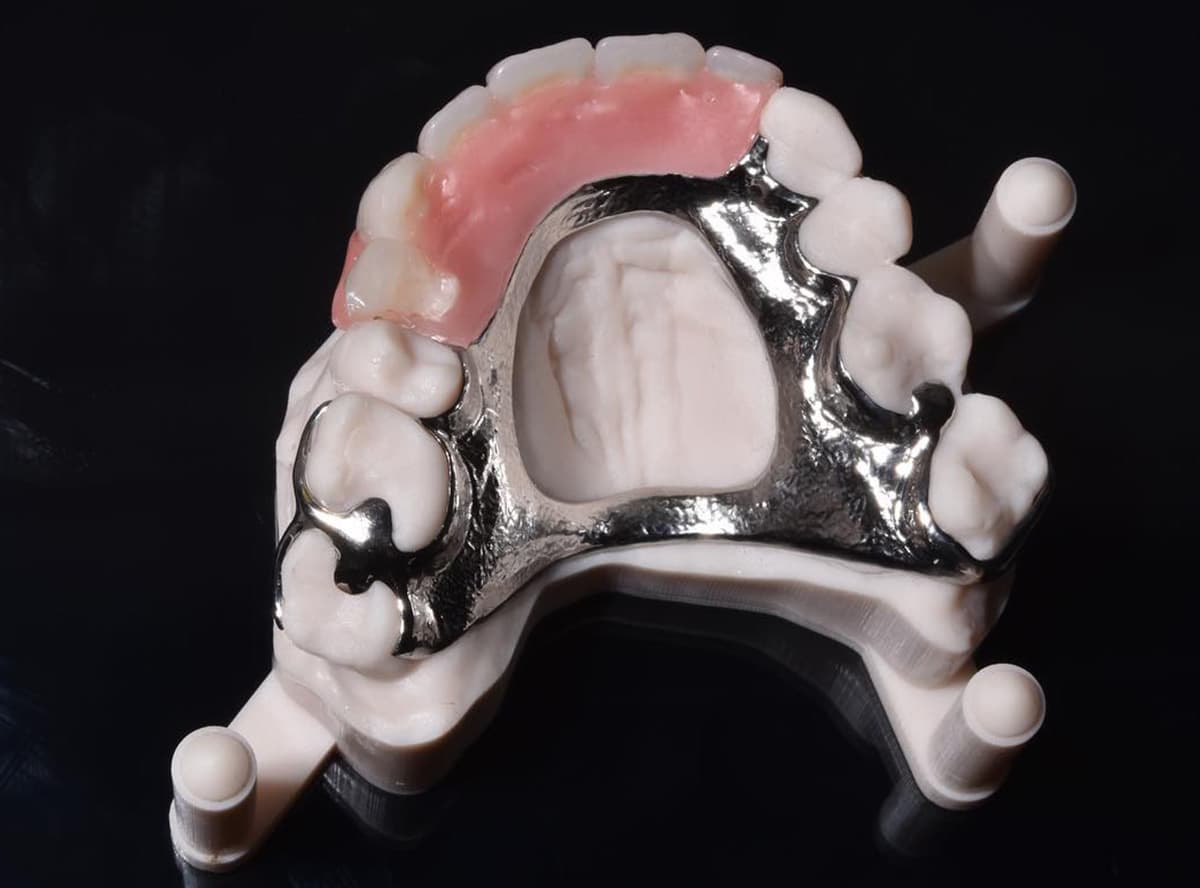 Denture