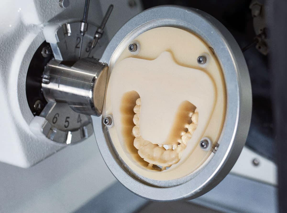 Temporary / Diagnostic Wax Up